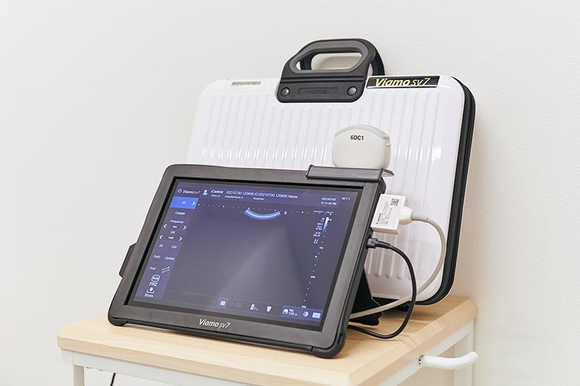 往診用 超音波検査機器